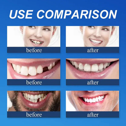 🏆Ends Today: 70% OFF! 🏆2026 Bestselling Product🦷 Fit for a Fresh Smile, Say Goodbye to Wearing Discomfort!
