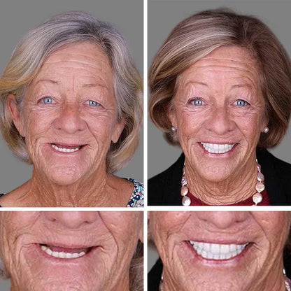 🏆Ends Today: 70% OFF! 🏆2026 Bestselling Product🦷 Fit for a Fresh Smile, Say Goodbye to Wearing Discomfort!