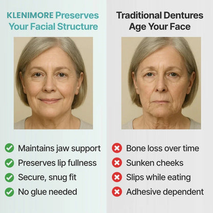 ⏰Ends Today: 70% OFF! 🌎KLENIMORE™ Custom-Fit  Dentures— Designed for Comfort and a Natural-Looking Smile
